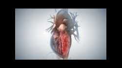 Acute Coronary Syndrome and Heart Attack