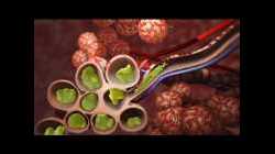 Pneumonia | Discharge Instructions | Nucleus Health