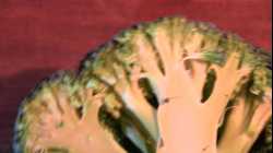 Cardiovascular System 5, Pulmonary vessels