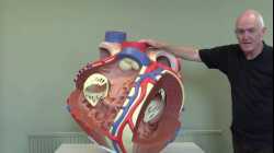 Cardiovascular System 11, Heart modle