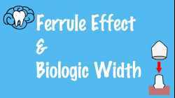 Ferrule Effect and Biologic Width