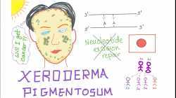 Xeroderma Pigmentosum