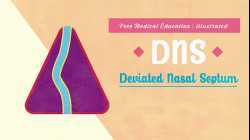 What is Deviated Nasal Septum (DNS)?
