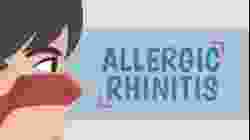 What is Allergic Rhinitis?