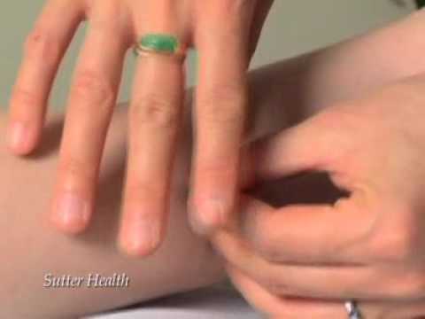 Alternative Medicine: Acupuncture