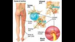 Kičma (diskusi) i zglobovi. Anatomija, fiziologija i patologija. Tretman patoloških stanja.