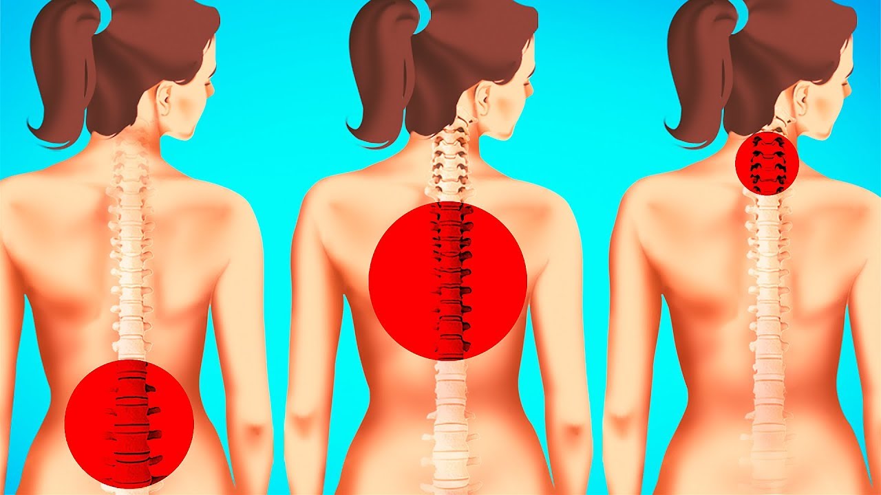 1-Minute Exercises to Improve Posture and Reduce Back Pain