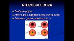 12  Ateroskleroza