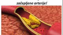 RECEPT za visok pritisak i začepljene arterije!