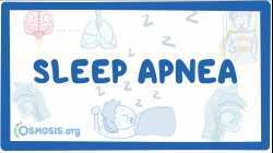 Sleep apnea - causes, symptoms, diagnosis, treatment, pathology