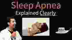 Obstructive Sleep Apnea Explained Clearly - Pathophysiology, Diagnosis, Treatment