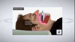 Beyond the Barriers: Obstructive Sleep Apnea Treatments