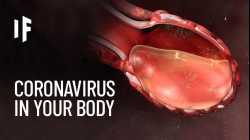 What Happens If You Caught The Coronavirus?