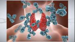 Understanding Autoimmune Thyroid Disease