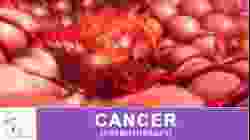 CANCER (CHEMOTHERAPY)