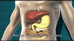 Diabetes and the body | Diabetes UK