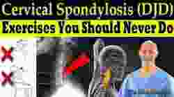 Cervical Spondylosis (DJD) Exercises You Should Never Do (Correct Exercises) - Dr. Alan Mandell, DC