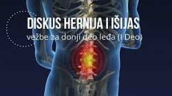 Vežbe za donji deo leđa diskus herniju i išijas - prvi deo